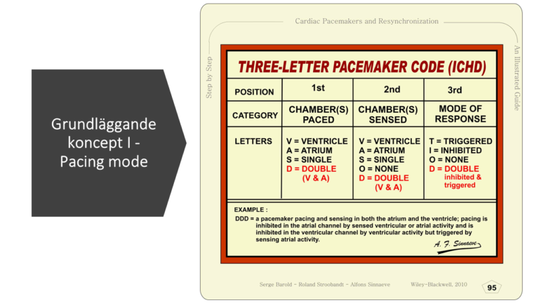 Pacemaker Overview: Device and Electrodes Explained - The Anesthesia Guide