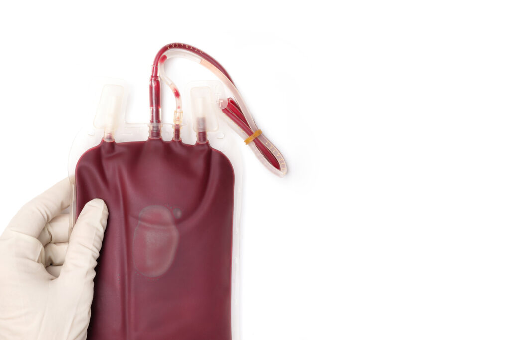 Fluid Resuscitation in Traumatic Bleeding – Treatment Principles - Akut ...