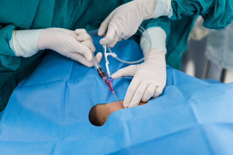 Central venous catheter – CVC insertion – indications, technique and ...
